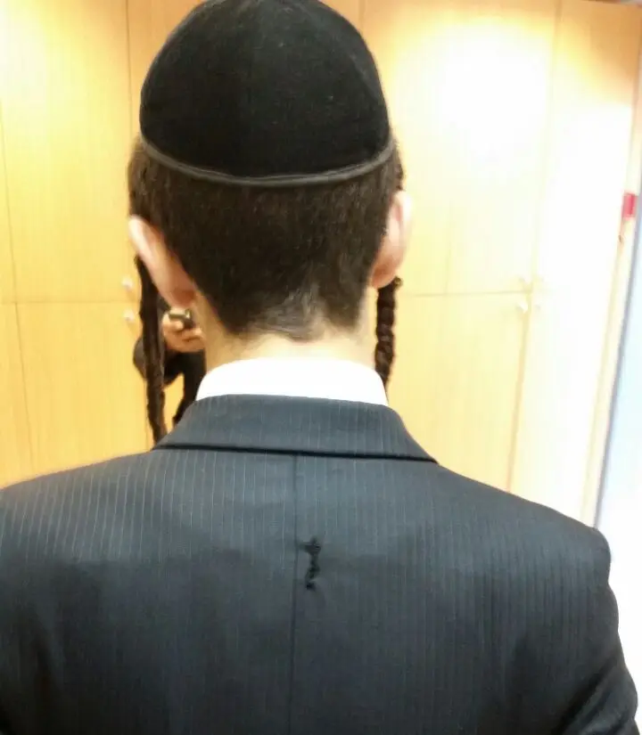 החור בבגדו של הפצוע