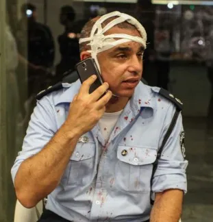 שוטר פצוע הפגנה